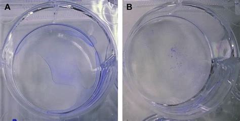 Growth of the (A) biofilm of the control and (B) biofilm of the sample ...