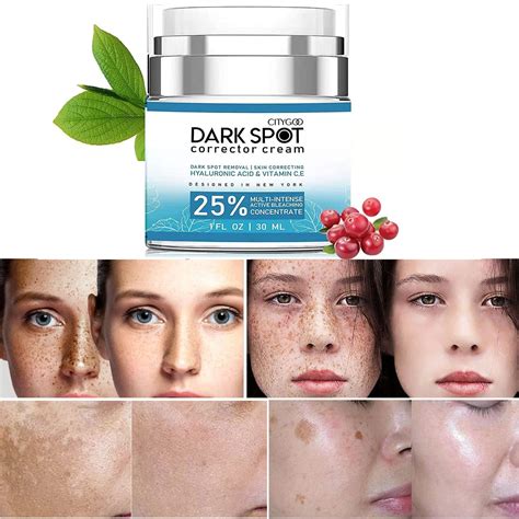 CITYGOO Dark Spot Remover Cream for Face & Body - Natural Skin Care for ...