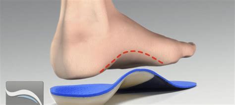 Benefits Of The Modern Day Custom Orthotic Insoles For Shoe Insert ...