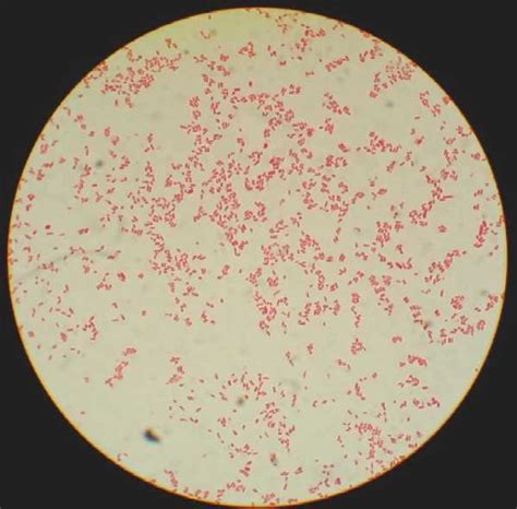 E Coli Microscope 1000x - Micropedia