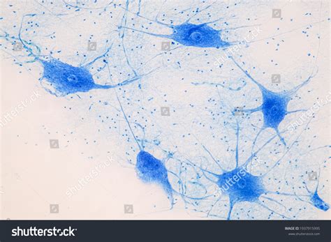 Human Nerve Cells Under Microscope