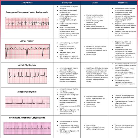 Ecg Interpretation