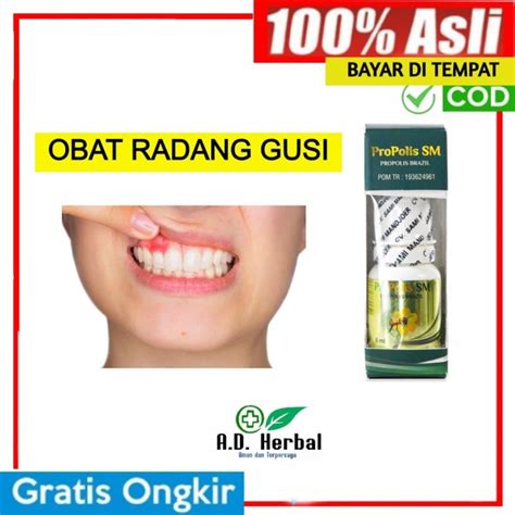 Jual OBAT radang gusi - sakit gigi berlubang - obat gusi bengkak ...