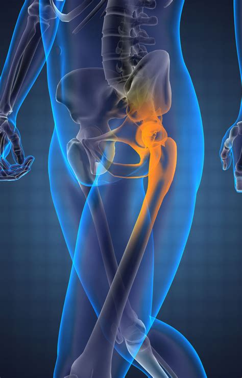 How Do You Treat Hip Pain? - Central Orthopedic Group