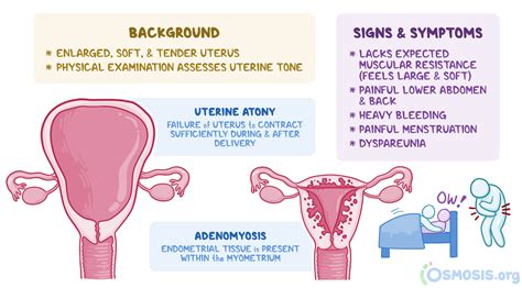 Tone of the uterus during pregnancy - Healthy Food Near Me