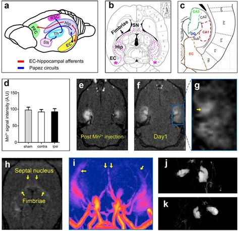 Manganese-enhanced MRI (MEMRI). (a) Schematic overview of afferents ...