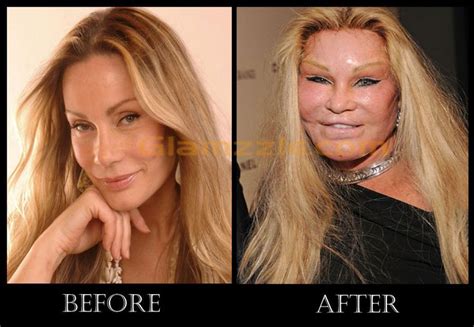 jocelyn wildenstein before surgery | ... Would Look Like → jocelyn ...