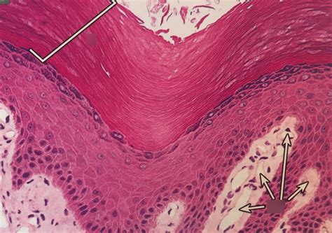 Stratified Squamous Keratinized Epithelium Labeled