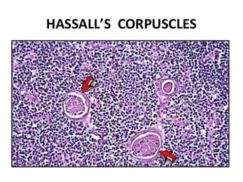 13 lymphoid organs dr kirti 21 dec (2)