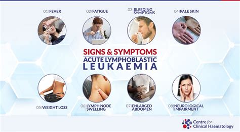 Acute Lymphoblastic Leukemia Symptoms