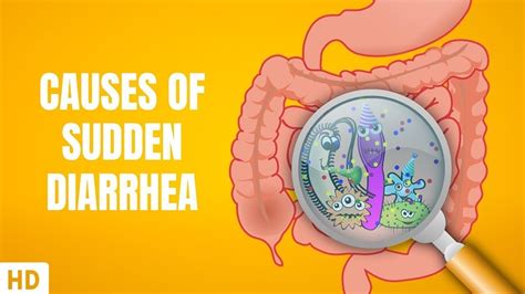 Causes of Sudden Diarrhea - YouTube