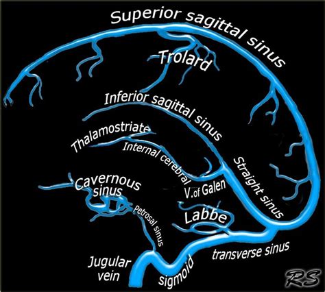 Venous drainage of Brain... (Vein of Galen = Great cerebral vein ...