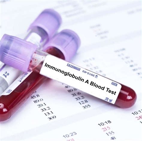 Immunoglobulin A Blood Test | Blood Tests in London