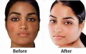 How to Lighten Skin – Overnight, Fast, Naturally Skin Whitening Home ...