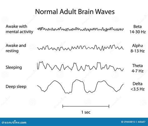 Normal eeg - reterpk