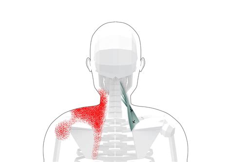 Back Knee Pain When Bending