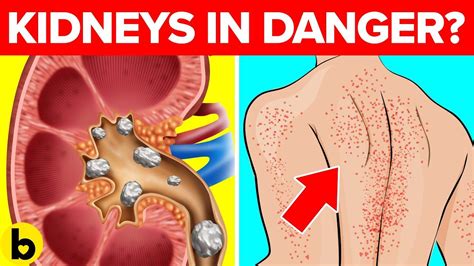 12 Signs That Your Kidneys Need Help | Kidney failure causes, Kidney ...