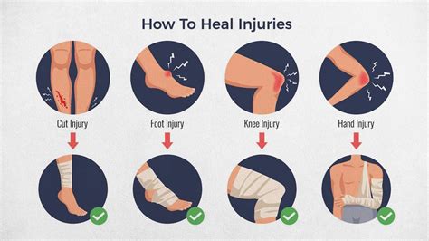 Common Sports Injuries And Their Prevention Tips | OnlyMyHealth