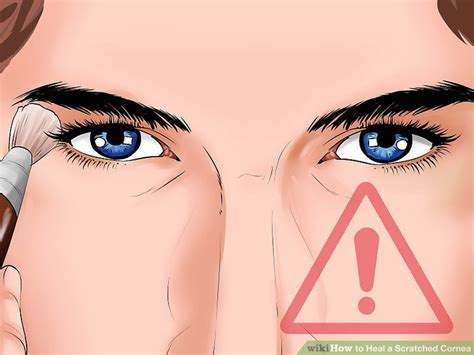 How to Heal a Scratched Cornea (with Pictures) - wikiHow