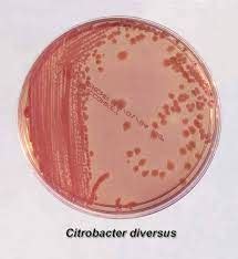 Citrobacter koseri - microbewiki