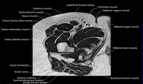 Pin on Radiology