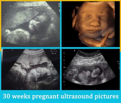 30 weeks pregnant ultrasound pictures