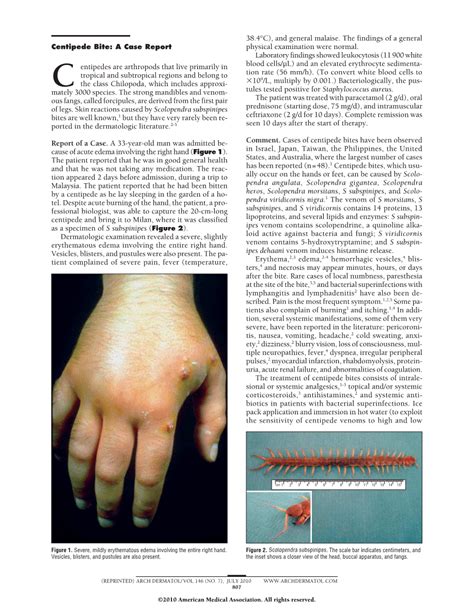 Centipede Bite: A Case Report | Dermatology | JAMA Dermatology | The ...