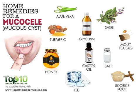 Home Remedies for a Mucocele (Mucous Cyst) | Top 10 Home Remedies