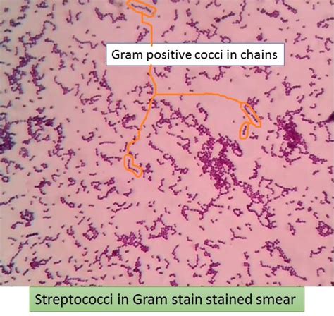 Streptococcus Pyogenes Gram Stain