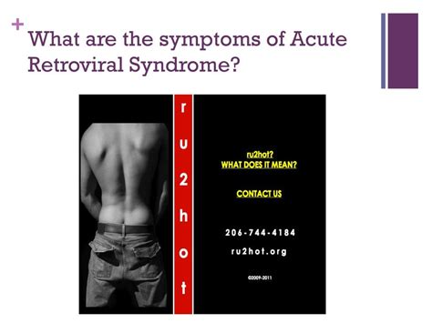 PPT - Acute Retroviral Syndrome PowerPoint Presentation, free download ...