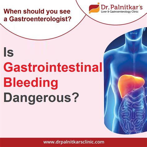 Is gastrointestinal bleeding dangerous? When should you see a ...