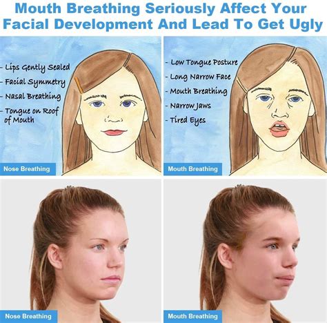 Mouth-breathing vs Nose-breathing: Effects on Face, Teeth, Jawline ...