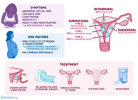 Leiomyoma of Uterus (Uterine Fibroid): What Is It, Causes, Types ...