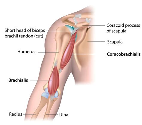 biceps tenodesis side effects