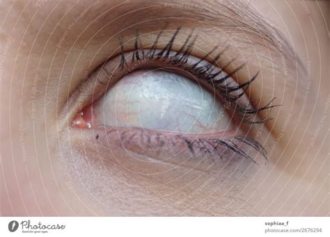 empty eye - white eyes without iris, blind - a Royalty Free Stock Photo ...