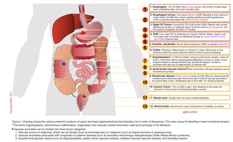 The Critical Gastrointestinal Hemorrhage: Evidence-Based Management ...