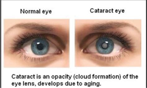 Cloudy vision! - Newspaper - DAWN.COM