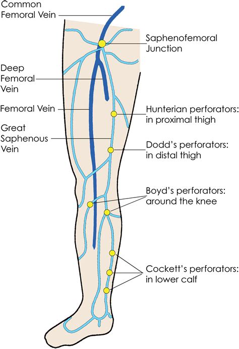 Ultrasound Evaluation of the Lower Extremity Veins - Radiologic Clinics