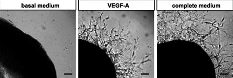 3D Angiogenesis Assay | Creative Bioarray