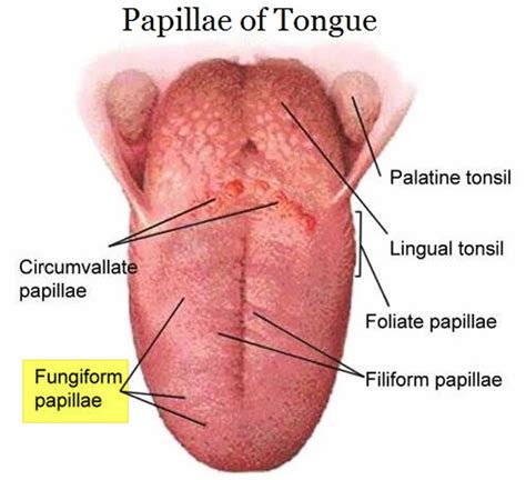 Smooth Tongue Anemia