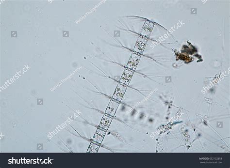 Chaetoceros Diatom Under Microscope View Stock Photo 632132858 ...