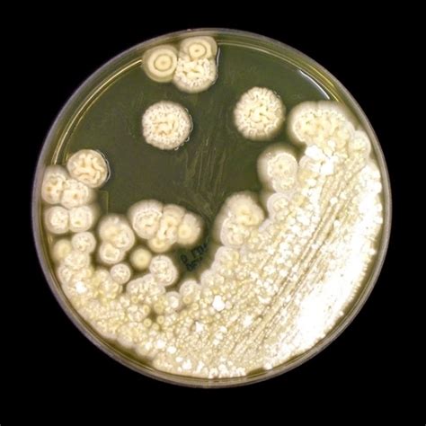 Fun With Microbiology (What's Buggin' You?): Trichosporon species