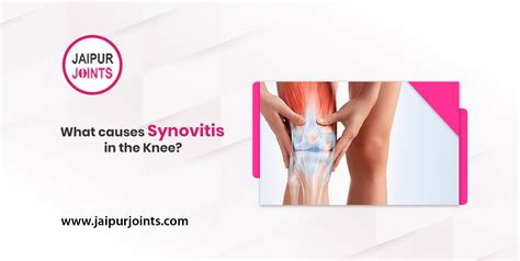 What causes Synovitis in the knee in 2022? | Synovitis Treatment in Jaipur