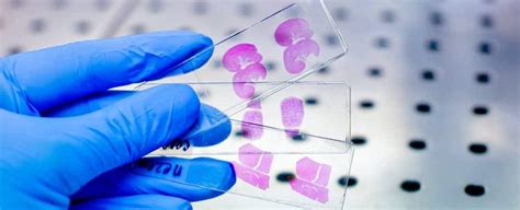 FFPE Tissue Samples | BioChain Institute Inc.