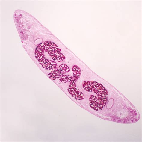 Clonorchis sinensis, c.s. Microscope Slide | Carolina.com