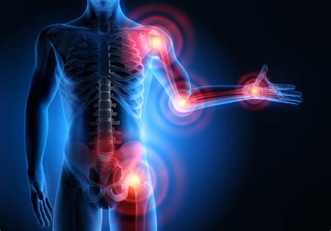 Joint Pain: Causes, Symptoms, and Management - VAD