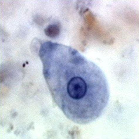 Entamoeba histolytica (trophozoite) | Motility: progressive ...