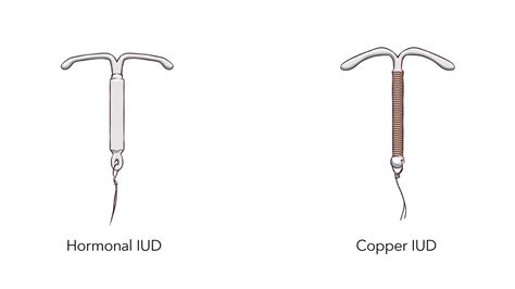 Types Of Birth Control Iud at Morris Bruns blog