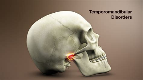 10 Ways to Help Manage Temporomandibular Joint Disorders - Medrot.com