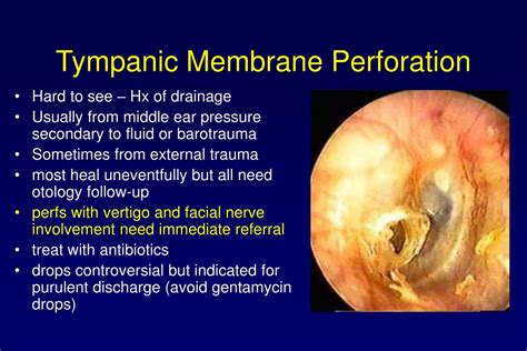 Perforated Tympanic Membrane Treatment